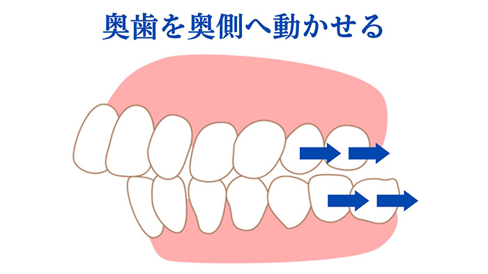静岡県浜松市のインビザライン認定医