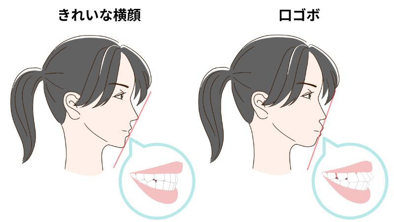 キレイな横顔と口ゴボ