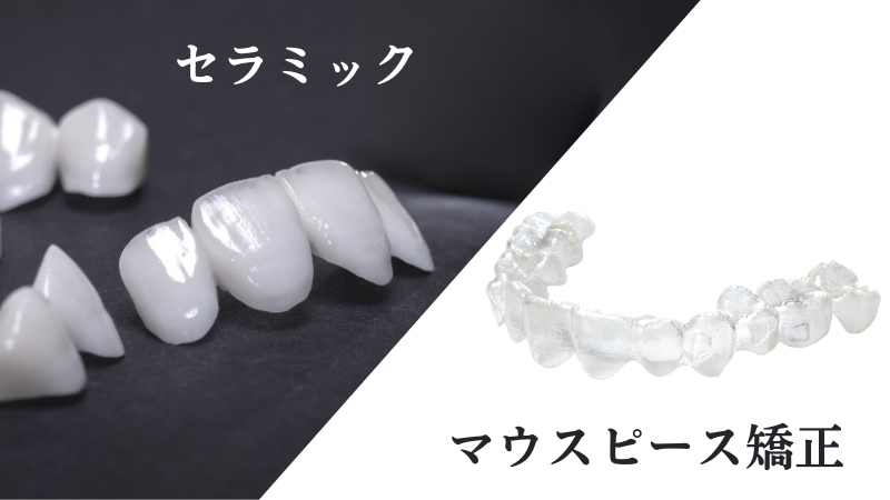 静岡県浜松市のスピード矯正