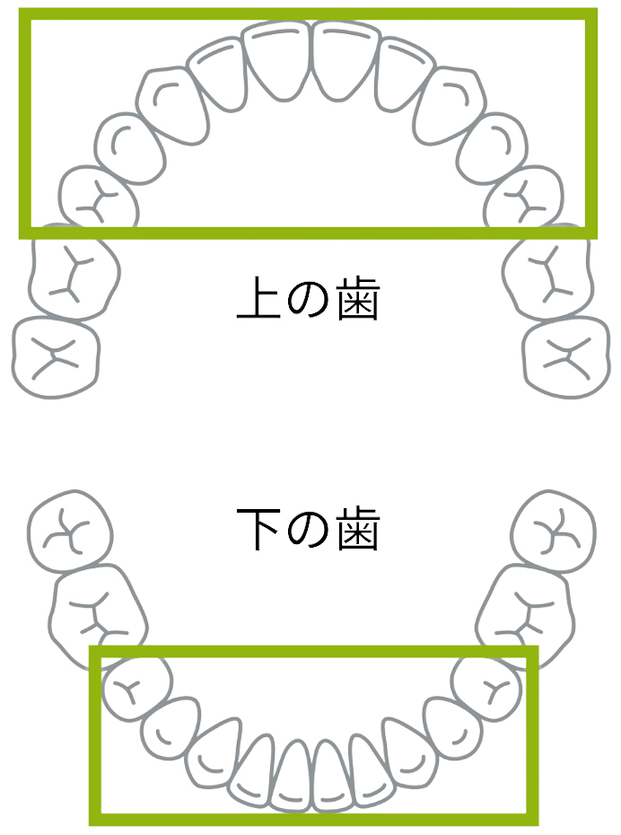 歯並び図