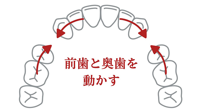 静岡県浜松市の後悔しない歯列矯正